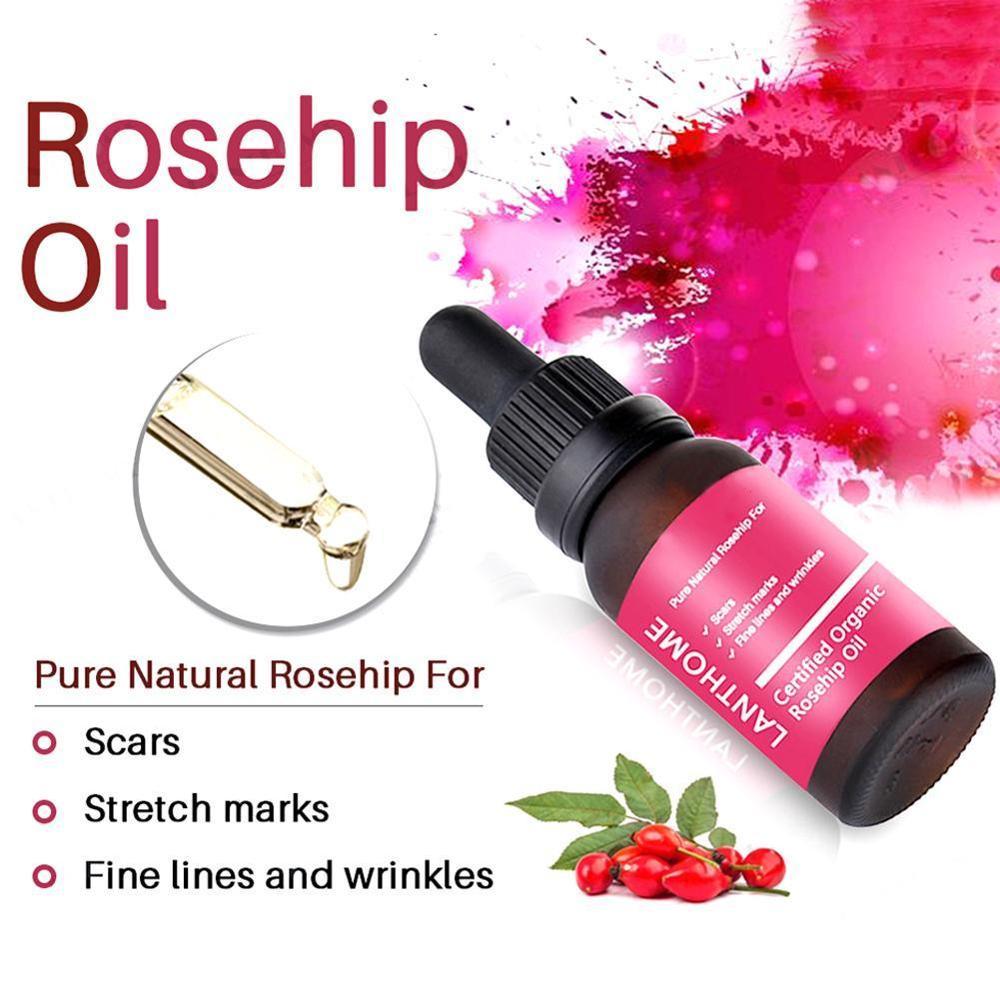 Moisturizing and moisturizing rosehip oil