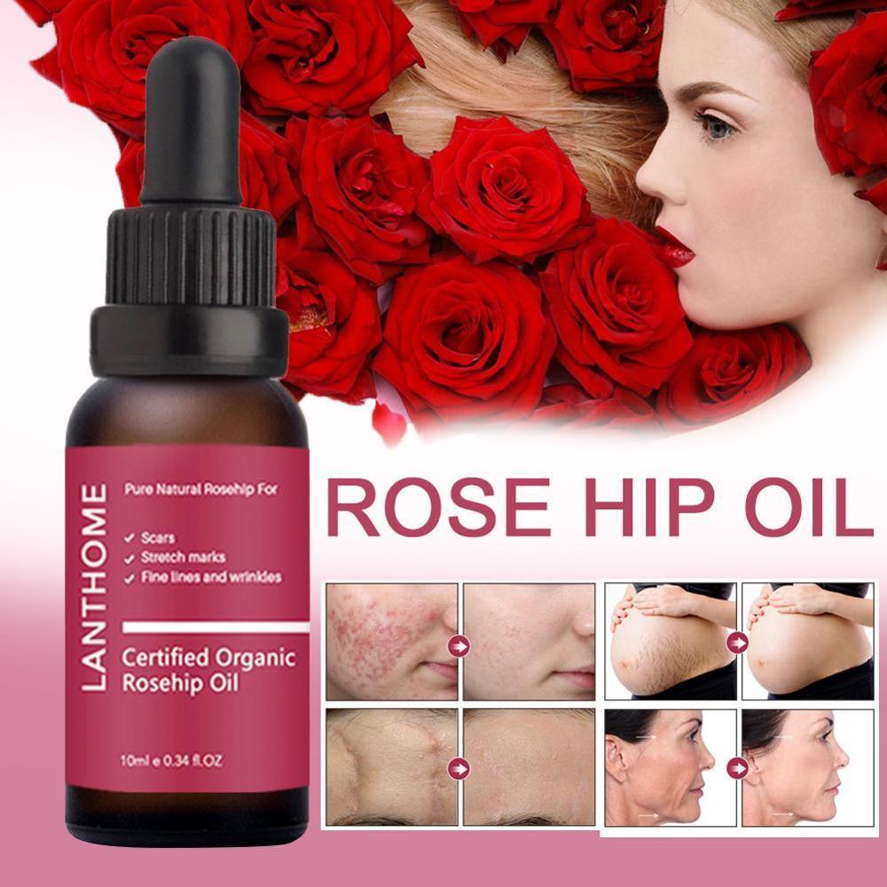 Moisturizing and moisturizing rosehip oil